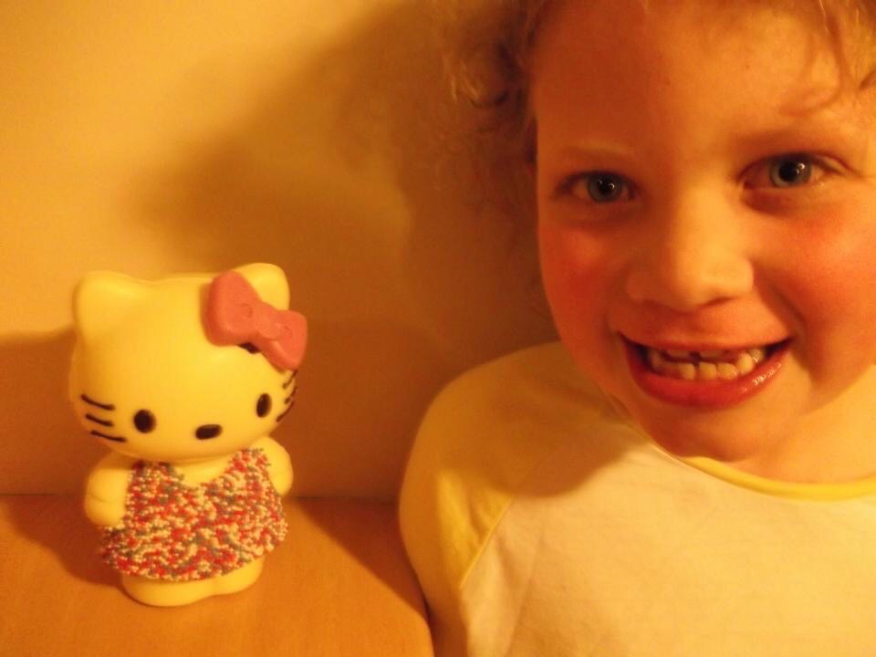 Six-Year-Old Tiegan-Elise stands ecstatically by white chocolate Hello Kitty shaped Easter Egg, showing her severe underbite.